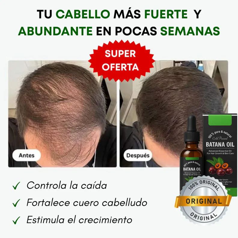 ACEITE BATANA ORIGINAL💫🔝