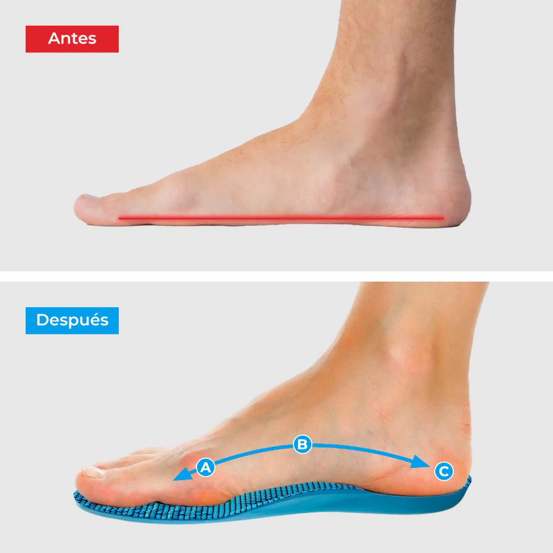 🔥Plantillas ComfyFeet ortopédica💎