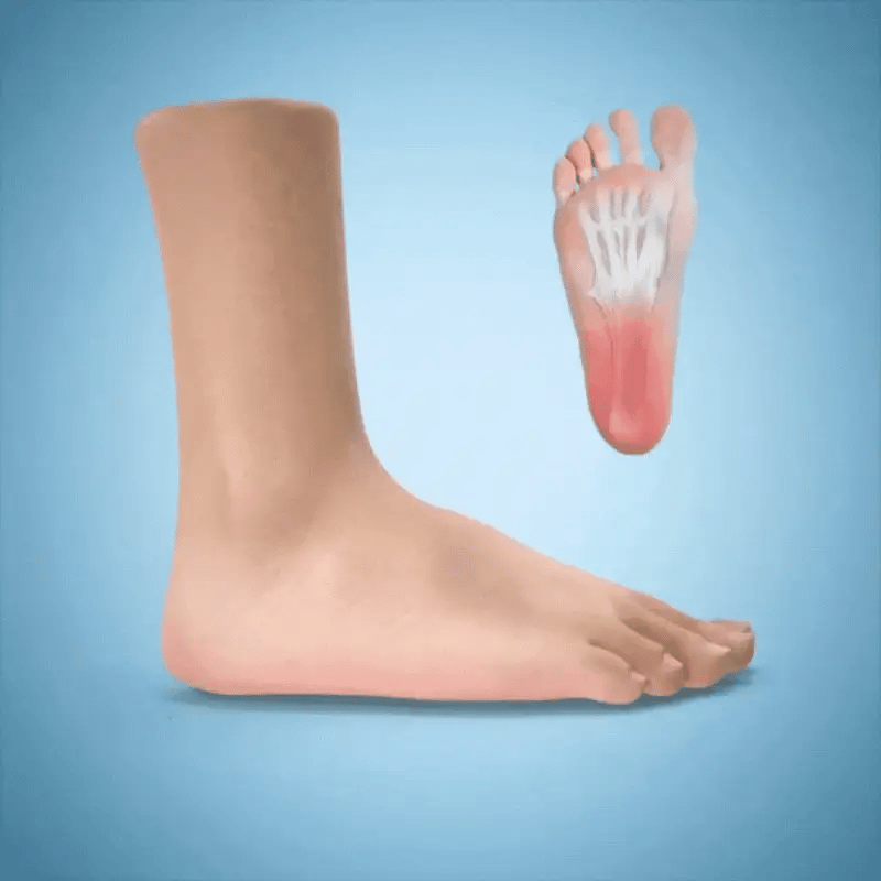 🔥Plantillas ComfyFeet ortopédica💎