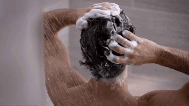 💎SHAMPOO ANTICANAS UNISEX👌😍